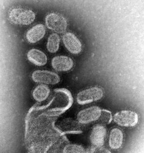 A microscopic image shows 1918 influenza virons recreated in 2005 at the National Center for Infectious Diseases. Centers for Disease Control and Prevention’s Public Health Image Library/Dr. Terrance Tumpey/Photo by Cynthia Goldsmith